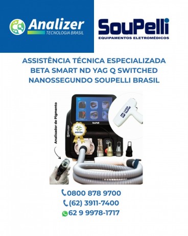 assistencia-laser-soupelli-brasil-big-1